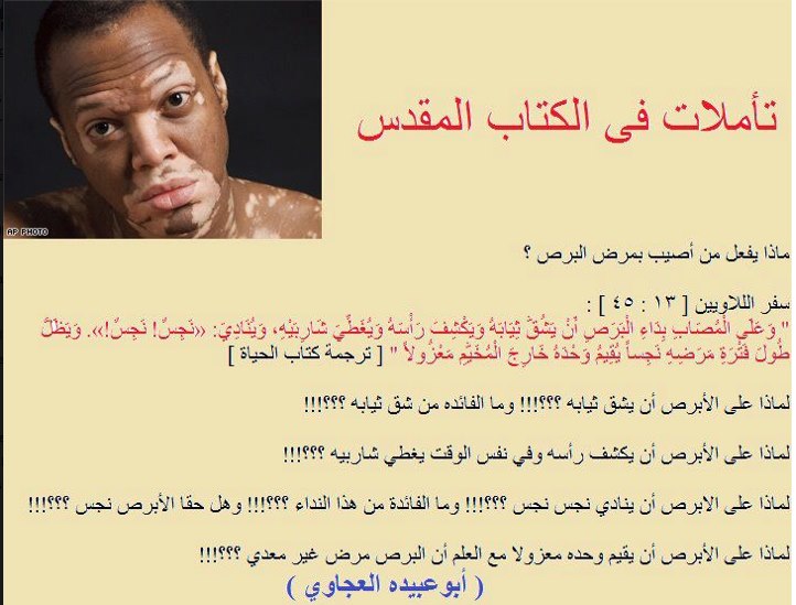 بالله عقوبة مريض البرص الكتاب المقدس