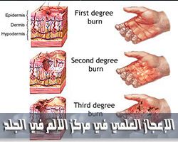 الإعجاز العلمي في مركز الألم في الجلد